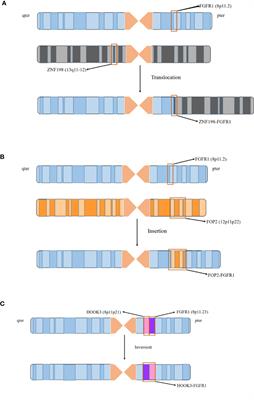 The 8p11 myeloproliferative syndrome: Genotypic and phenotypic classification and targeted therapy